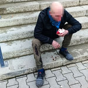 krvacející muž krvacející muž